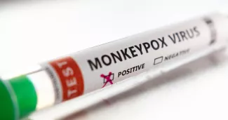 Un test positif au virus de la monkeypox (variole du singe).